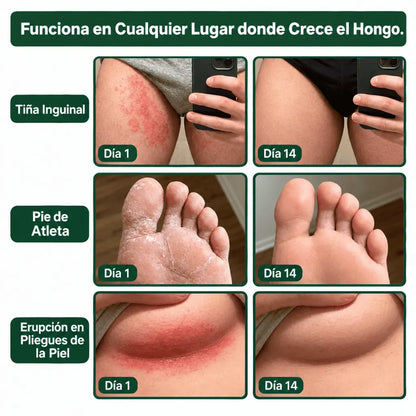 Dermisec Crema Antifúngica