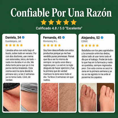 Dermisec Crema Antifúngica
